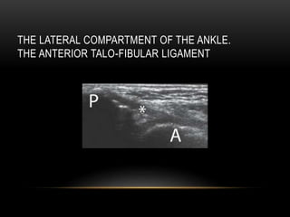 THE LATERAL COMPARTMENT OF THE ANKLE.
THE ANTERIOR TALO-FIBULAR LIGAMENT
 