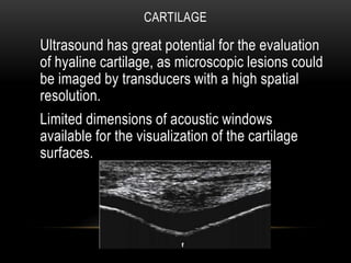 • The most frequent artifacts in the examination of
cartilage profile is the angle of insonation.
• As in the examination ...