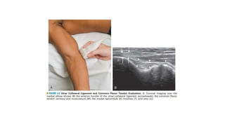 Elbow joint USG(MSK).pptx