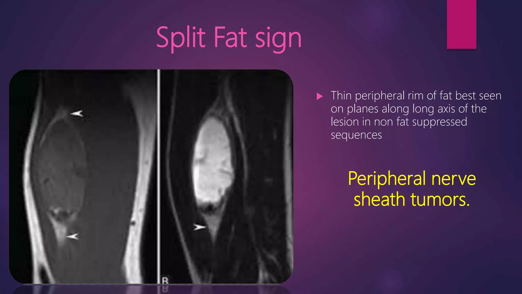 Msk signs edited | PPTX