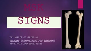 MSK
SIGNS
DR. DALIA EL SAIED MD
GENERAL ORGANIZATION FOR TEACHING
HOSPITALS AND INSTITUTES.
 