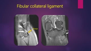 Fibular collateral ligament
Biceps
FCL
FCL
 