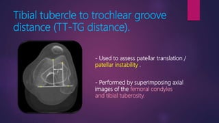 Tibial tubercle to trochlear groove
distance (TT-TG distance).
- Used to assess patellar translation /
patellar instability .
- Performed by superimposing axial
images of the femoral condyles
and tibial tuberosity.
 