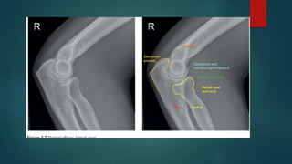 Msk x ray normal anatomy | PPTX
