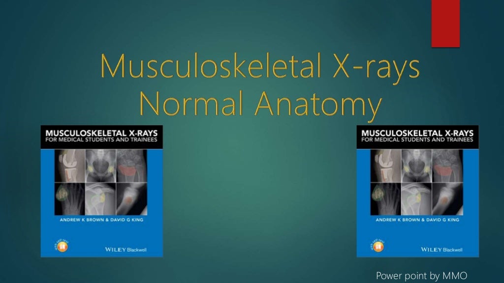 Msk x ray normal anatomy