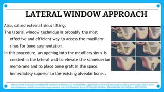MSLP : Maxillary sinus lift procedures ppt | PPTX