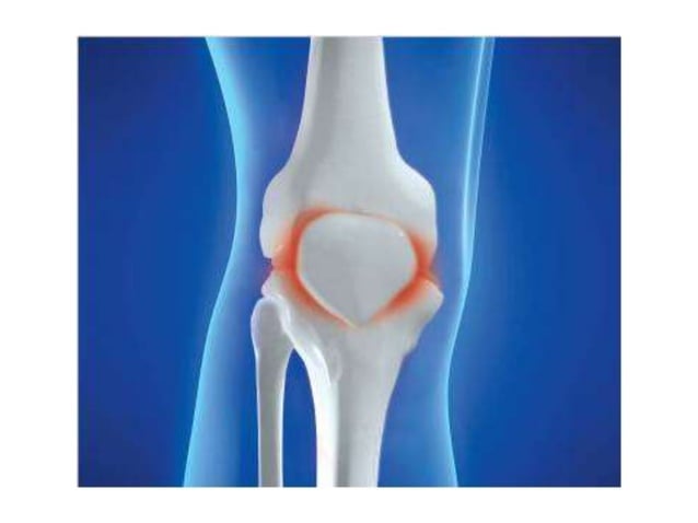 Msm for joints | PPT