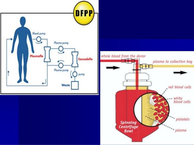 Guillain Barre Syndrome