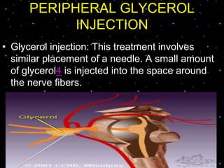 PERIPHERAL GLYCEROL
INJECTION
• Glycerol injection: This treatment involves
similar placement of a needle. A small amount
of glycerol4 is injected into the space around
the nerve fibers.
 