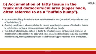 b) Accumulation of fatty tissue in the
trunk and dorsocervical area (upper back,
often referred to as a "buffalo hump").
 Accumulation of fatty tissue in the trunk and dorsocervical area (upper back, often referred to as
a "buffalo hump").
 Cushing's syndrome is a hormonal disorder caused by prolonged exposure of the body's tissues
to high levels of cortisol, a hormone produced by the adrenal glands.
 This distinct fat distribution pattern is due to the effects of excess cortisol, which promotes fat
deposition in certain areas of the body while other areas, like the arms and legs, may experience
muscle wasting, making the fat deposition in the trunk and upper back even more pronounced.
Mark Abejo
abejo
 