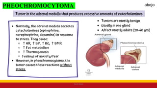 PHEOCHROMOCYTOMA
Mark Abejo
abejo
 