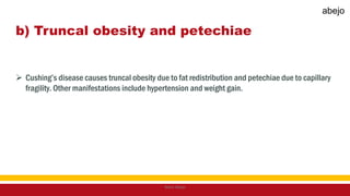 b) Truncal obesity and petechiae
 Cushing’s disease causes truncal obesity due to fat redistribution and petechiae due to capillary
fragility. Other manifestations include hypertension and weight gain.
Mark Abejo
abejo
 