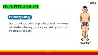 HYPOPITUITARISM
Mark Abejo
abejo
 