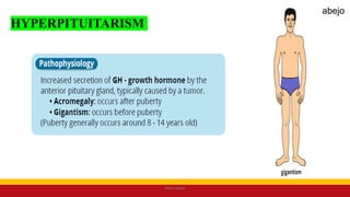 HYPERPITUITARISM
Mark Abejo
abejo
 