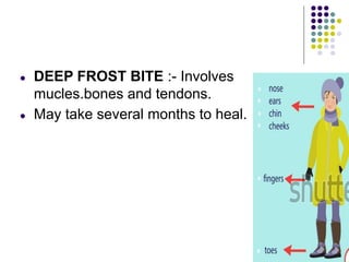● DEEP FROST BITE :- Involves
mucles.bones and tendons.
● May take several months to heal.
 