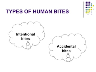 TYPES OF HUMAN BITES
Accidental
bites
Intentional
bites
 
