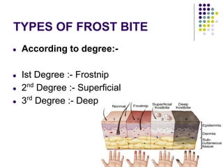 TYPES OF FROST BITE
● According to degree:-
● Ist Degree :- Frostnip
● 2nd
Degree :- Superficial
● 3rd
Degree :- Deep
 