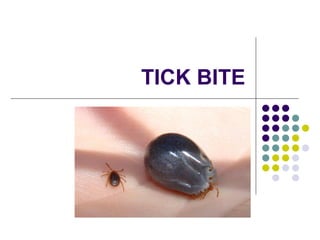 TICK BITE
 