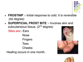● FROSTNIP :- Initial response to cold. It is reversible
.(Ist degree)
● SUPERFICIAL FROST BITE :- Involves skin and
subcutaneous tissue. (2nd
degree)
Sites are:- Ears
Nose
Fingers
Toes
Cheeks
Healing occurs in one month.
 