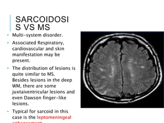 SARCOIDOSI
S VS MS
• Multi-system disorder.
• Associated Respiratory,
cardiovascular and skin
manifestation may be
present.
• The distribution of lesions is
quite similar to MS.
Besides lesions in the deep
WM, there are some
juxtaiventricular lesions and
even Dawson finger-like
lesions.
• Typical for sarcoid in this
case is the leptomeningeal
 