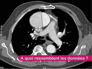 A quoi ressemblent les données ?
 