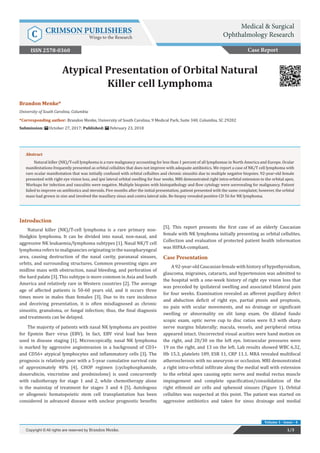 Brandon Menke*
University of South Carolina, Columbia
*Corresponding author: Brandon Menke, University of South Carolina, 9 Medical Park, Suite 340, Columbia, SC 29202
Submission: October 27, 2017; Published: February 23, 2018
Atypical Presentation of Orbital Natural
Killer cell Lymphoma
Introduction
Natural killer (NK)/T-cell lymphoma is a rare primary non-
Hodgkin lymphoma. It can be divided into nasal, non-nasal, and
aggressive NK leukaemia/lymphoma subtypes [1]. Nasal NK/T cell
lymphoma refers to malignancies originating in the nasopharyngeal
area, causing destruction of the nasal cavity, paranasal sinuses,
orbits, and surrounding structures. Common presenting signs are
midline mass with obstruction, nasal bleeding, and perforation of
the hard palate [3]. This subtype is more common in Asia and South
America and relatively rare in Western countries [2]. The average
age of affected patients is 50-60 years old, and it occurs three
times more in males than females [3]. Due to its rare incidence
and deceiving presentation, it is often misdiagnosed as chronic
sinusitis, granuloma, or fungal infection; thus, the final diagnosis
and treatments can be delayed.
The majority of patients with nasal NK lymphoma are positive
for Epstein Barr virus (EBV). In fact, EBV viral load has been
used in disease staging [1]. Microscopically, nasal NK lymphoma
is marked by aggressive angioinvasion in a background of CD3+
and CD56+ atypical lymphocytes and inflammatory cells [3]. The
prognosis is relatively poor with a 5-year cumulative survival rate
of approximately 40% [4]. CHOP regimen (cyclophosphamide,
doxorubicin, vincristine and prednisolone) is used concurrently
with radiotherapy for stage 1 and 2, while chemotherapy alone
is the mainstay of treatment for stages 3 and 4 [5]. Autologous
or allogeneic hematopoietic stem cell transplantation has been
considered in advanced disease with unclear prognostic benefits
[5]. This report presents the first case of an elderly Caucasian
female with NK lymphoma initially presenting as orbital cellulites.
Collection and evaluation of protected patient health information
was HIPAA-compliant.
Case Presentation
A 92-year-old Caucasian female with history of hypothyroidism,
glaucoma, migraines, cataracts, and hypertension was admitted to
the hospital with a one-week history of right eye vision loss that
was preceded by ipsilateral swelling and associated bilateral pain
for four weeks. Examination revealed an afferent pupillary defect
and abduction deficit of right eye, partial ptosis and proptosis,
no pain with ocular movements, and no drainage or significant
swelling or abnormality on slit lamp exam. On dilated fundo
scopic exam, optic nerve cup to disc ratios were 0.3 with sharp
nerve margins bilaterally; macula, vessels, and peripheral retina
appeared intact. Uncorrected visual acuities were hand motion on
the right, and 20/30 on the left eye. Intraocular pressures were
19 on the right, and 13 on the left. Lab results showed WBC 6.32,
Hb 15.3, platelets 189, ESR 11, CRP 11.1. MRA revealed multifocal
atherosclerosis with no aneurysm or occlusion. MRI demonstrated
a right intra-orbital infiltrate along the medial wall with extension
to the orbital apex causing optic nerve and medial rectus muscle
impingement and complete opacification/consolidation of the
right ethmoid air cells and sphenoid sinuses (Figure 1). Orbital
cellulites was suspected at this point. The patient was started on
aggressive antibiotics and taken for sinus drainage and medial
Case Report
Medical & Surgical
Ophthalmology ResearchC CRIMSON PUBLISHERS
Wings to the Research
Abstract
Natural killer (NK)/T-cell lymphoma is a rare malignancy accounting for less than 1 percent of all lymphomas in North America and Europe. Ocular
manifestations frequently presented as orbital cellulites that does not improve with adequate antibiotics. We report a case of NK/T cell lymphoma with
rare ocular manifestation that was initially confused with orbital cellulites and chronic sinusitis due to multiple negative biopsies. 92-year-old female
presented with right eye vision loss, and ipsi lateral orbital swelling for four weeks. MRI demonstrated right intra-orbital extension to the orbital apex.
Workups for infection and vasculitis were negative. Multiple biopsies with histopathology and flow cytology were unrevealing for malignancy. Patient
failed to improve on antibiotics and steroids. Five months after the initial presentation, patient presented with the same complaint; however, the orbital
mass had grown in size and involved the maxillary sinus and contra lateral side. Re-biopsy revealed positive CD 56 for NK lymphoma.
1/3Copyright © All rights are reserved by Brandon Menke.
Volume 1 - Issue - 4
ISSN 2578-0360
 