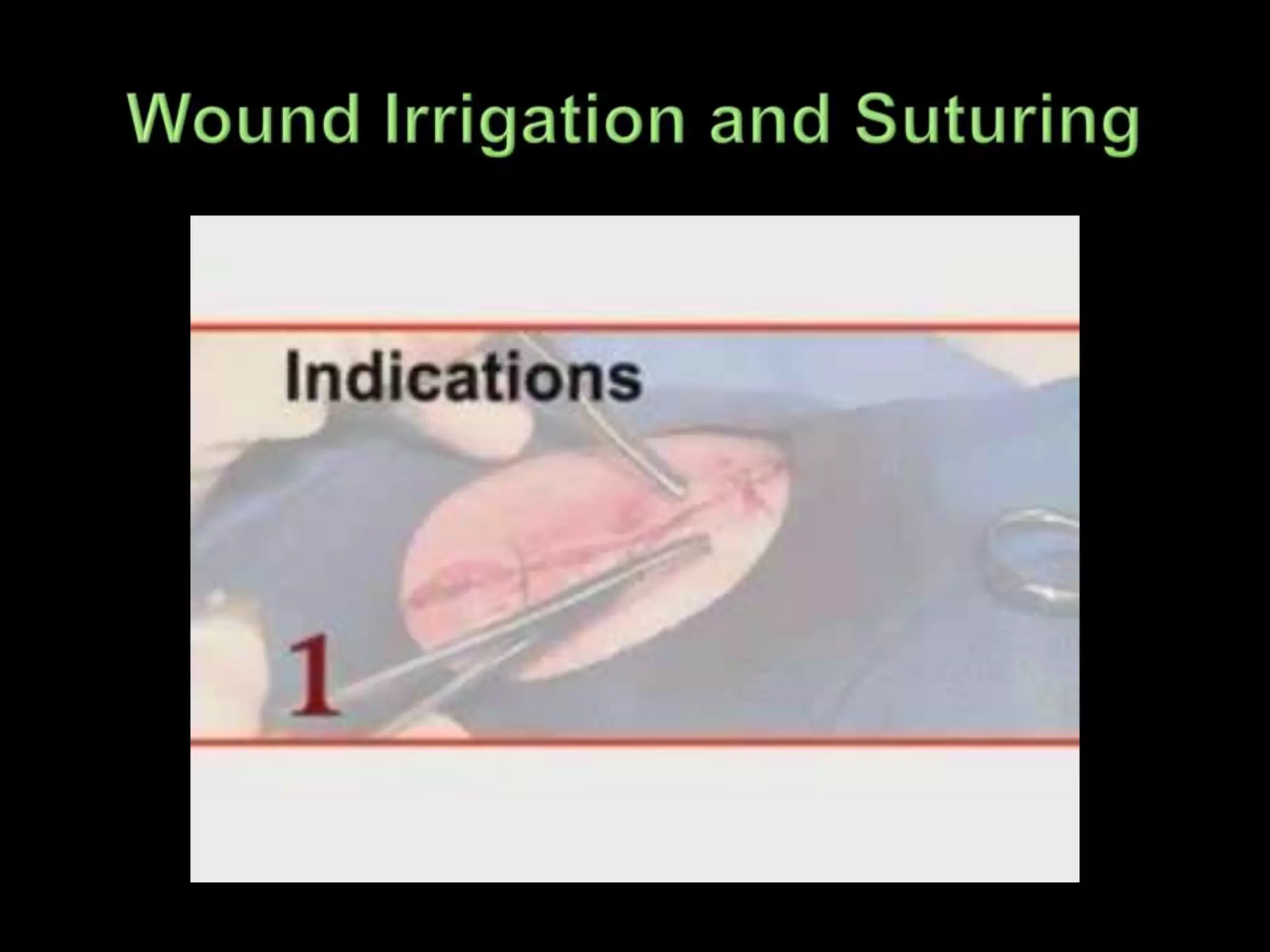 Wound Irrigation and Suturing