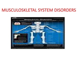 MUSCULOSKLETAL SYSTEM DISORDERS
 