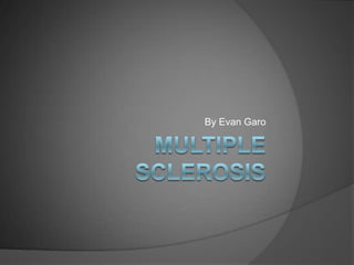 Multiple Sclerosis By Evan Garo 