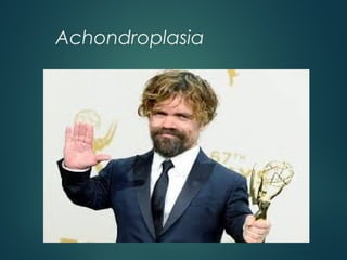 Achondroplasia
 
