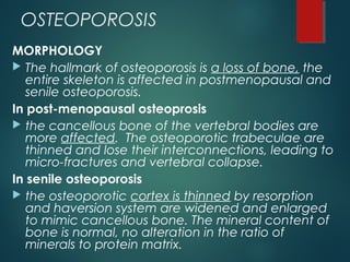 OSTEOPOROSIS
MORPHOLOGY
 The hallmark of osteoporosis is a loss of bone, the
entire skeleton is affected in postmenopausal and
senile osteoporosis.
In post-menopausal osteoprosis
 the cancellous bone of the vertebral bodies are
more affected. The osteoporotic trabeculae are
thinned and lose their interconnections, leading to
micro-fractures and vertebral collapse.
In senile osteoporosis
 the osteoporotic cortex is thinned by resorption
and haversion system are widened and enlarged
to mimic cancellous bone. The mineral content of
bone is normal, no alteration in the ratio of
minerals to protein matrix.
 