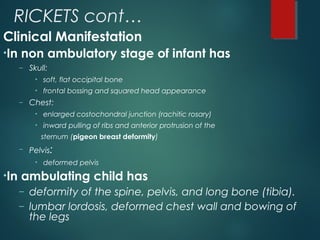 RICKETS cont…
Clinical Manifestation
•In non ambulatory stage of infant has
– Skull:
• soft, flat occipital bone
• frontal bossing and squared head appearance
– Chest:
• enlarged costochondral junction (rachitic rosary)
• inward pulling of ribs and anterior protrusion of the
sternum (pigeon breast deformity)
– Pelvis:
• deformed pelvis
•In ambulating child has
– deformity of the spine, pelvis, and long bone (tibia).
– lumbar lordosis, deformed chest wall and bowing of
the legs
 