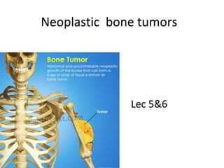 Neoplastic bone tumors
Lec 5&6
 