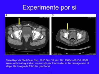 Case Reports BMJ Case Rep. 2015 Dec 10; doi: 10.1136/bcr-2015-211582.
Water-only fasting and an exclusively plant foods diet in the management of
stage IIIa, low-grade follicular lymphoma
11
Experimente por si
 