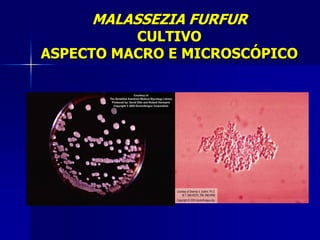 MALASSEZIA FURFUR
          CULTIVO
ASPECTO MACRO E MICROSCÓPICO
 