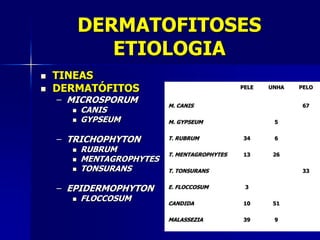 DERMATOFITOSES
             ETIOLOGIA
   TINEAS
   DERMATÓFITOS                               PELE   UNHA   PELO

    – MICROSPORUM
                           M. CANIS                           67
         CANIS
         GYPSEUM          M. GYPSEUM                  5


    – TRICHOPHYTON         T. RUBRUM           34      6

         RUBRUM
                           T. MENTAGROPHYTES   13      26
         MENTAGROPHYTES
         TONSURANS        T. TONSURANS                       33


    – EPIDERMOPHYTON       E. FLOCCOSUM         3

         FLOCCOSUM        CANDIDA             10      51


                           MALASSEZIA          39      9
 
