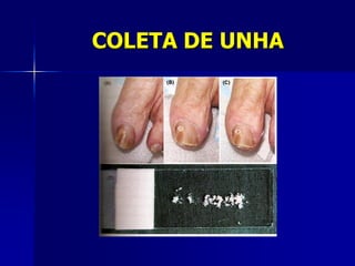 COLETA DE UNHA
 
