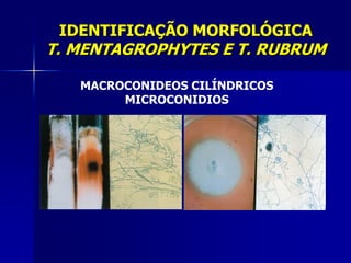 IDENTIFICAÇÃO MORFOLÓGICA
T. MENTAGROPHYTES E T. RUBRUM

   MACROCONIDEOS CILÍNDRICOS
        MICROCONIDIOS
 