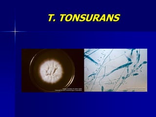 T. TONSURANS
 