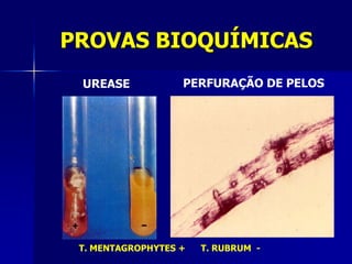 PROVAS BIOQUÍMICAS
 UREASE            PERFURAÇÃO DE PELOS




 T. MENTAGROPHYTES +   T. RUBRUM -
 