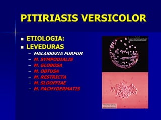 PITIRIASIS VERSICOLOR
   ETIOLOGIA:
   LEVEDURAS
    –   MALASSEZIA FURFUR
    –   M. SYMPODIALIS
    –   M. GLOBOSA
    –   M. OBTUSA
    –   M. RESTRICTA
    –   M. SLOOFFIAE
    –   M. PACHYDERMATIS
 
