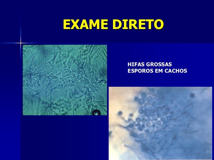 Exame micologico