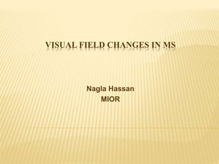 VISUAL FIELD CHANGES IN MS
Nagla Hassan
MIOR
 