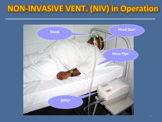 Approach to Mechanical ventilation | PPTX