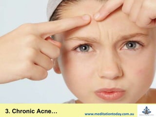 3. Chronic Acne… www.meditationtoday.com.au
 