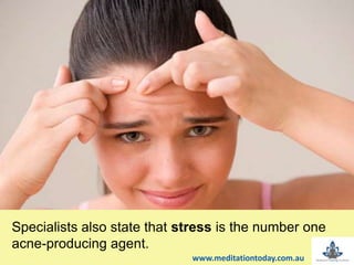 Specialists also state that stress is the number one
acne-producing agent.
www.meditationtoday.com.au
 