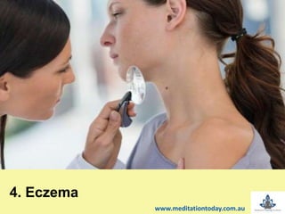 4. Eczema
www.meditationtoday.com.au
 