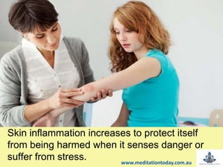 Skin inflammation increases to protect itself
from being harmed when it senses danger or
suffer from stress. www.meditationtoday.com.au
 