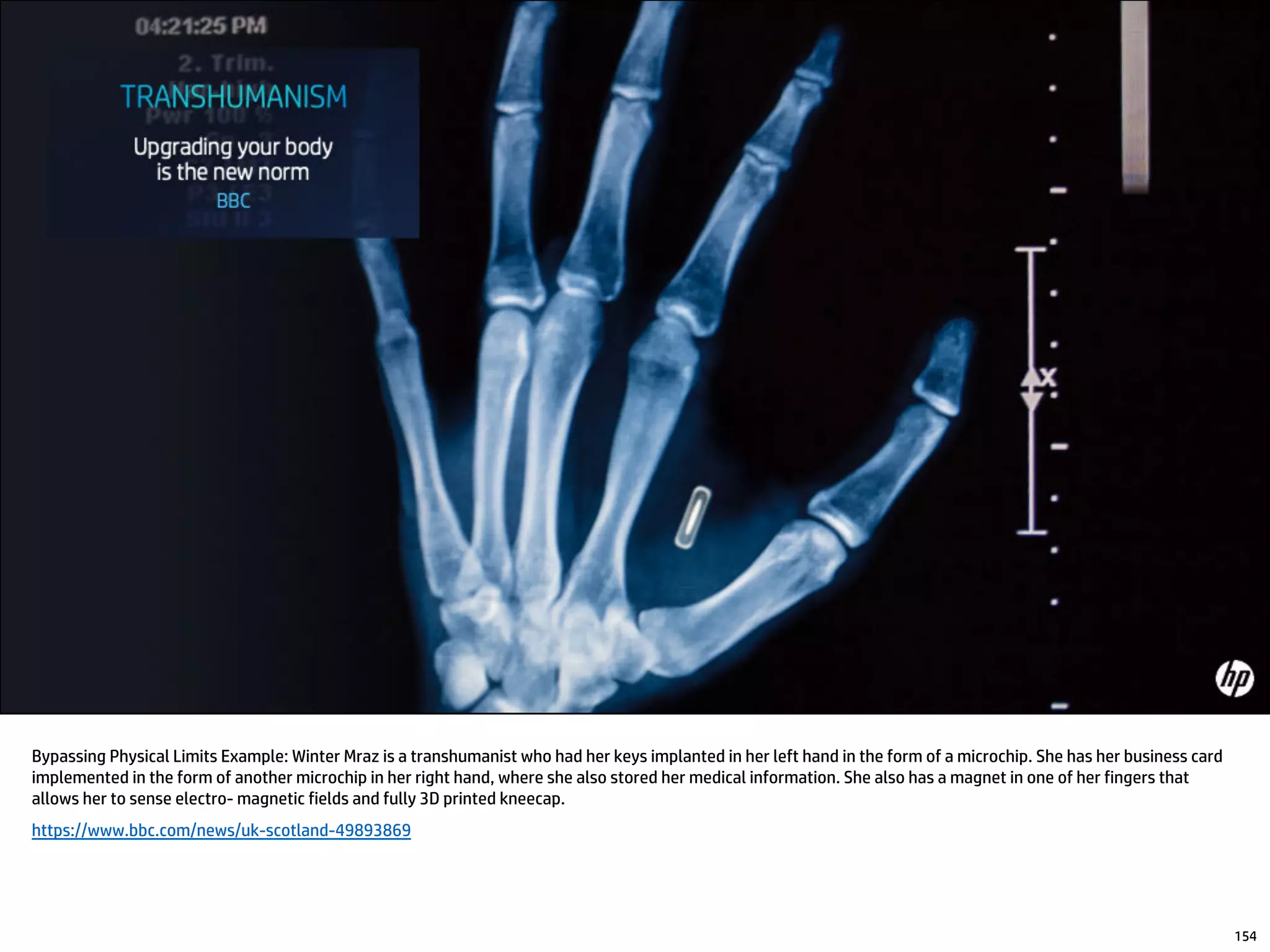 Bypassing Physical Limits Example: Winter Mraz is a transhumanist who had her keys implanted in her left hand in the form of a microchip. She has her business card
implemented in the form of another microchip in her right hand, where she also stored her medical information. She also has a magnet in one of her fingers that
allows her to sense electro- magnetic fields and fully 3D printed kneecap.
https://www.bbc.com/news/uk-scotland-49893869
154
 