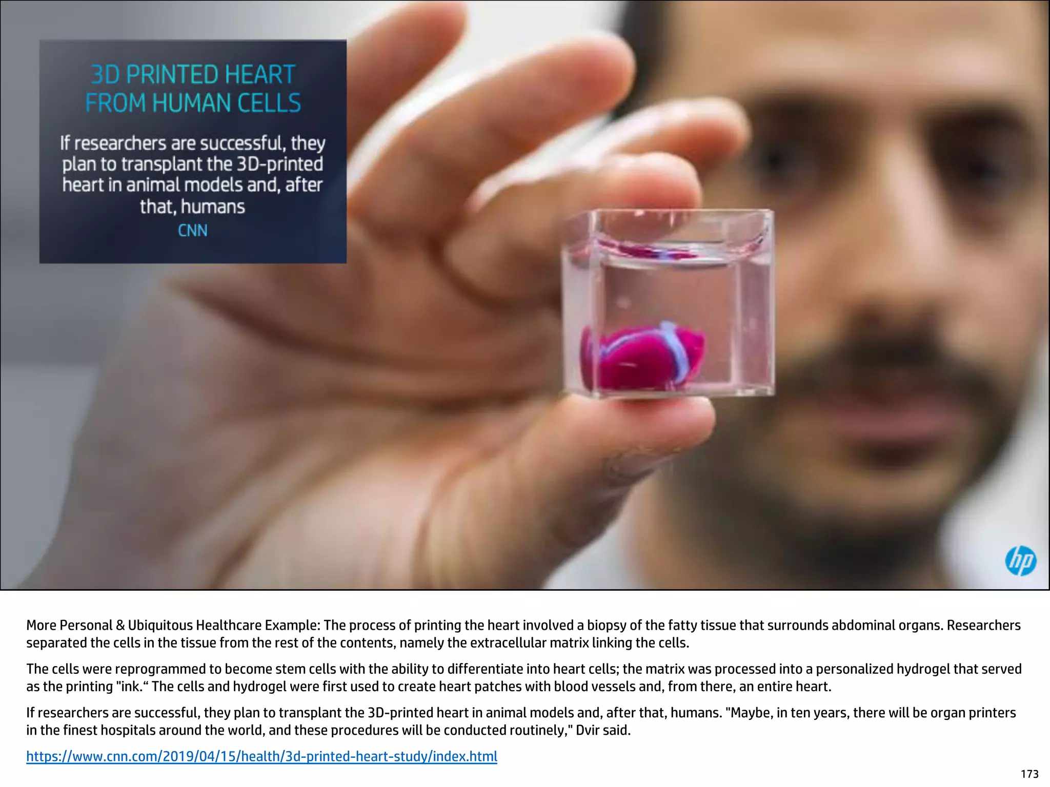 More Personal & Ubiquitous Healthcare Example: The process of printing the heart involved a biopsy of the fatty tissue that surrounds abdominal organs. Researchers
separated the cells in the tissue from the rest of the contents, namely the extracellular matrix linking the cells.
The cells were reprogrammed to become stem cells with the ability to differentiate into heart cells; the matrix was processed into a personalized hydrogel that served
as the printing "ink.“ The cells and hydrogel were first used to create heart patches with blood vessels and, from there, an entire heart.
If researchers are successful, they plan to transplant the 3D-printed heart in animal models and, after that, humans. "Maybe, in ten years, there will be organ printers
in the finest hospitals around the world, and these procedures will be conducted routinely," Dvir said.
https://www.cnn.com/2019/04/15/health/3d-printed-heart-study/index.html
173
 